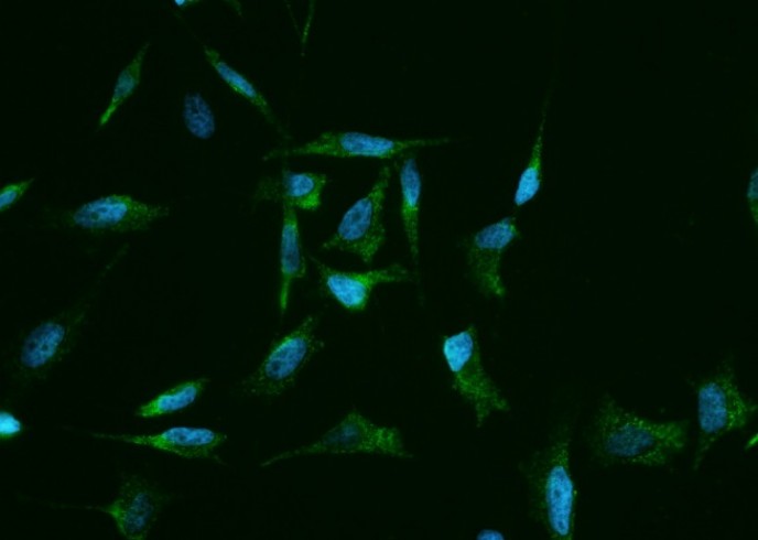 Clusterin/Apolipoprotein J/Apo-J/CLU Monoclonal Antibody - small - 2