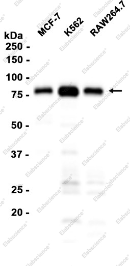 Recombinant TAK1 Monoclonal Antibody - 1