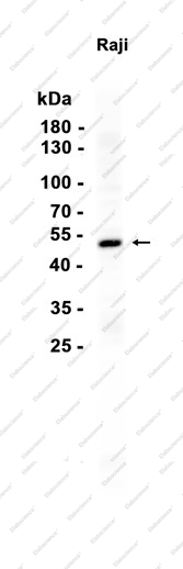 Recombinant DDB2 Monoclonal Antibody - 1