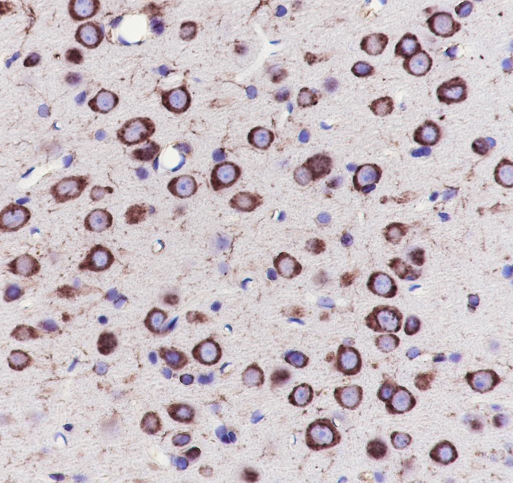 Recombinant eEF1A2 Monoclonal Antibody - small - 5