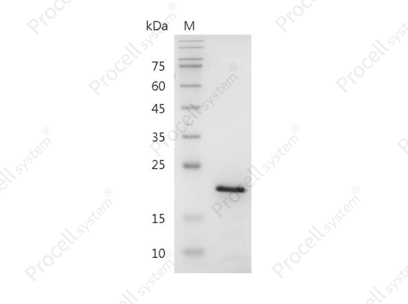 FGF-10/FGFA/KGF2, Human, Recombinant