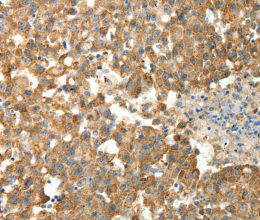 PRDX3 Polyclonal Antibody - 2