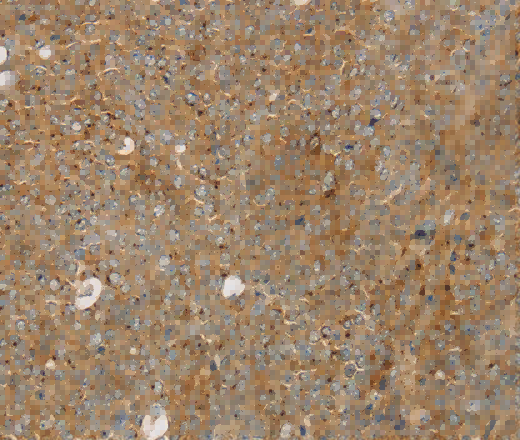 STX16 Polyclonal Antibody - 3
