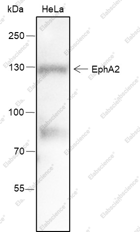 Recombinant EphA2 Monoclonal Antibody - 1