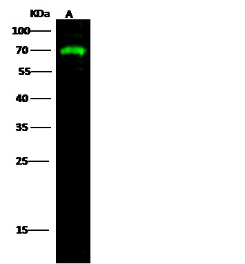 Recombinant AFP/alpha-fetoprotein Monoclonal Antibody - 2