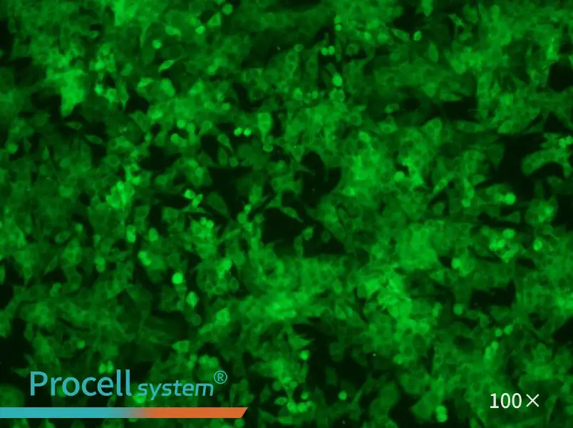 Panc02-GFP - 1
