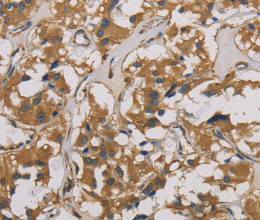 CORO1C Polyclonal Antibody - 2