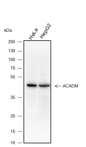Recombinant ACADM Monoclonal Antibody-searchlist-1