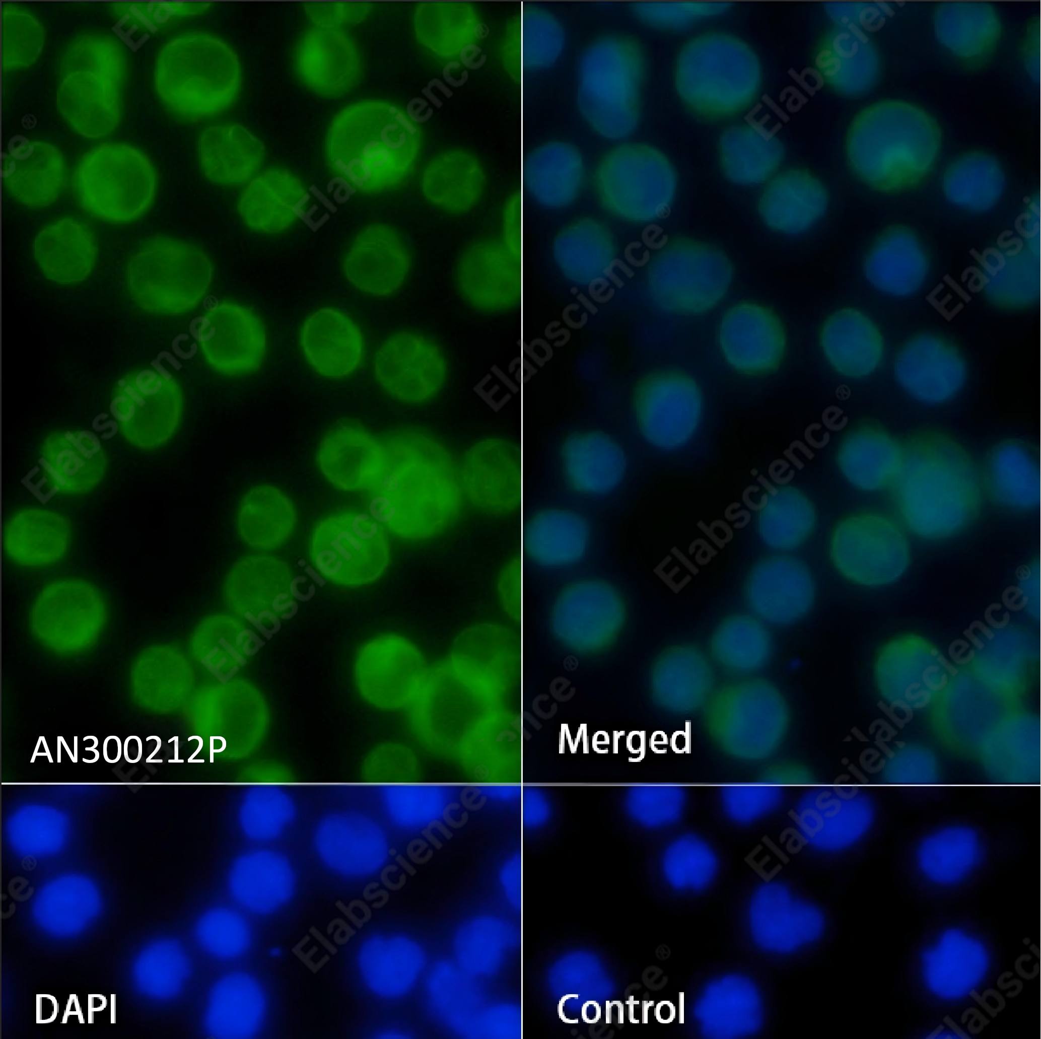 Recombinant CD3d/CD3 delta Monoclonal Antibody - 3
