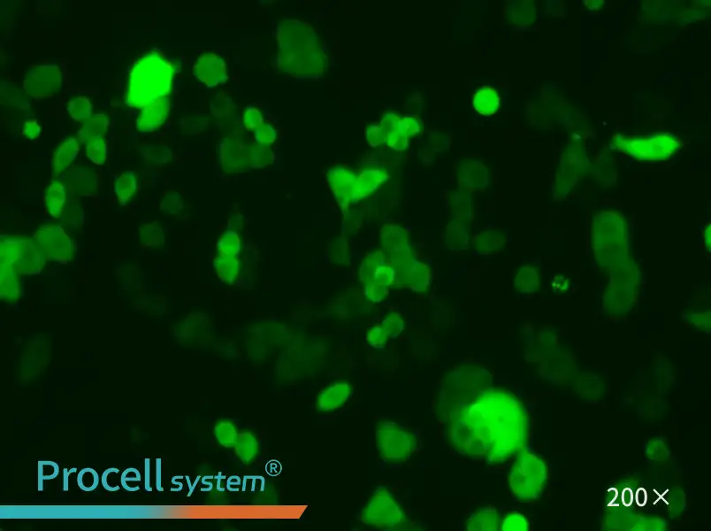 4T1-GFP - 4