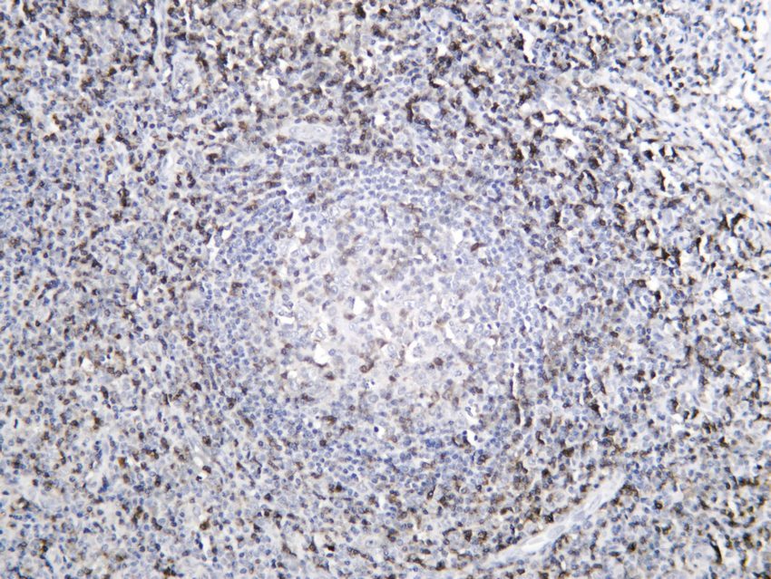 Recombinant CD5/Cluster of Differentiation 5 Monoclonal Antibody - 2