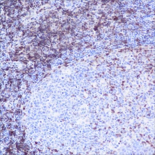 Recombinant CD3G Monoclonal Antibody - small - 2