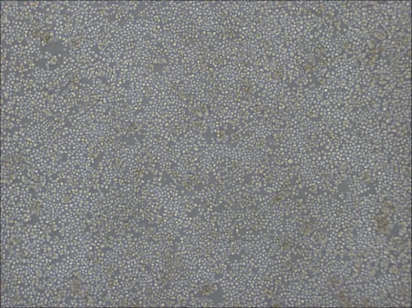 DoHH2 Cell Complete MediumDoHH2 Cell Complete Medium - 3