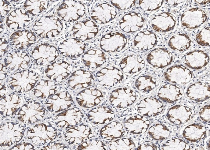 HIGD1A Polyclonal Antibody - small - 2