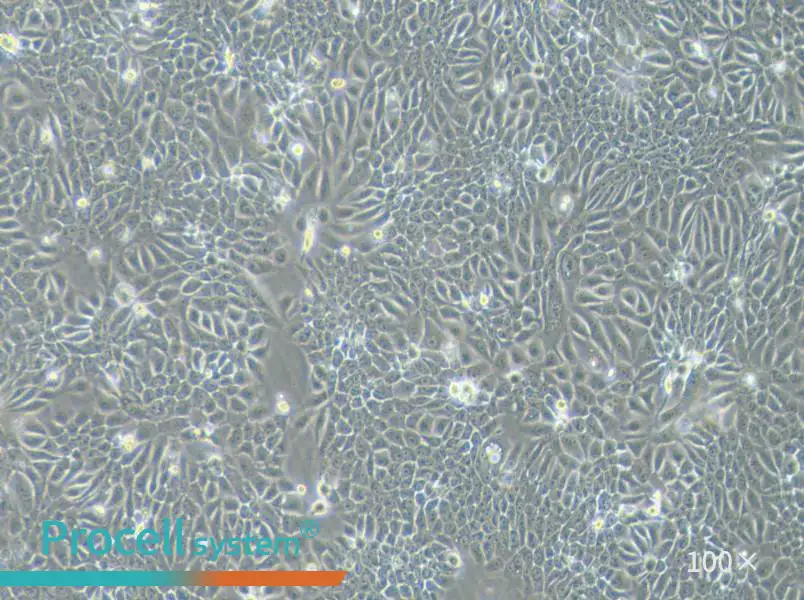 Eca-109 Cell Complete Medium - 1