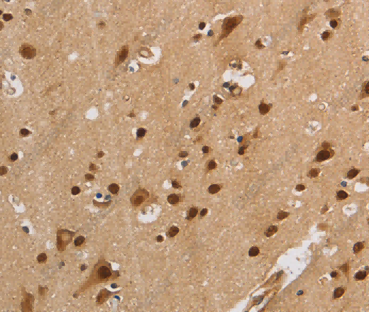 KCNG4 Polyclonal Antibody - 3