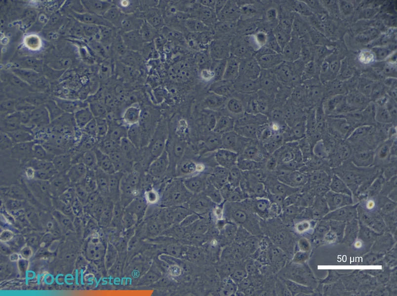 Human Type II Alveolar Epithelial (Primary cell immortalization) Cell Complete Medium - 10