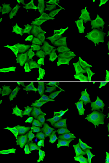 Immunofluorescence analysis of HeLa cells using SPINT2 Polyclonal Antibody Blue: DAPI for nuclear staining.