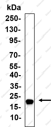 Recombinant HMGA1 Monoclonal Antibody - 1