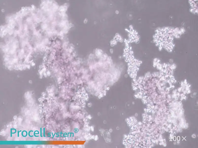 NCI-H660 Cell Complete MediumNCI-H660 Cell Complete Medium - 2