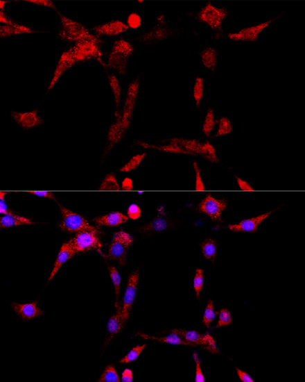 Immunofluorescence analysis of PC-12 cells using CYP1B1 Polyclonal Antibody at dilution of 1:100 (40x lens). Blue: DAPI for nuclear staining.