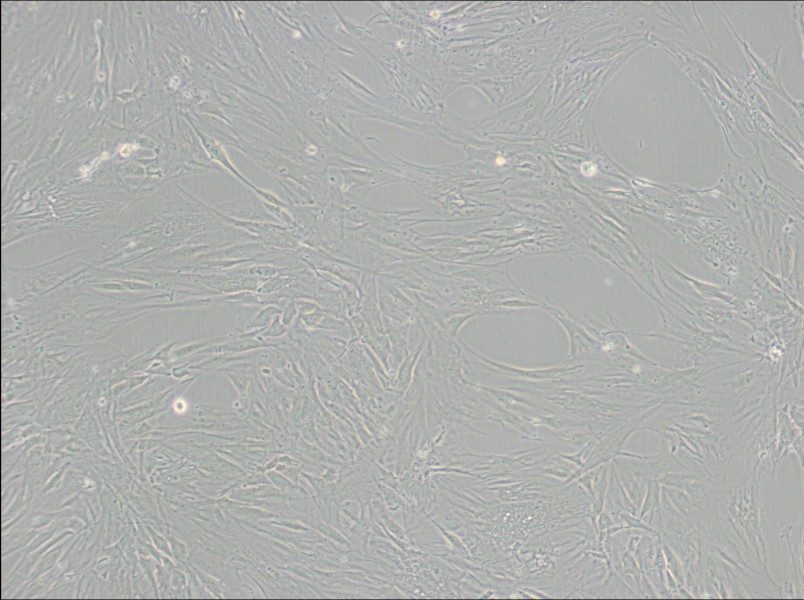 CCD-1095Sk Cell Complete Medium - 2