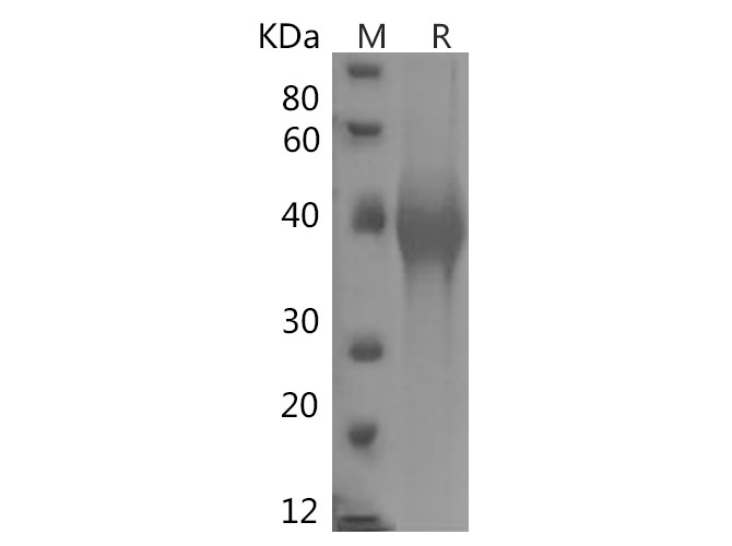 Recombinant Human TNF-α Protein(Gst Tag)-产品推荐-1