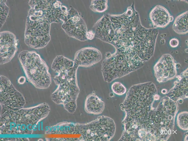NCI-H1781 Cell Complete Medium - 5