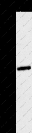 MAGEA10 Polyclonal Antibody - 1
