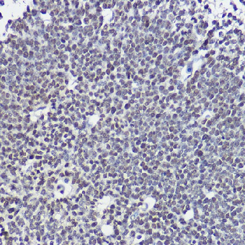 Immunohistochemistry of paraffin-embedded mouse embryos using SOX1 Polyclonal Antibody at dilution of 1:20 (40x lens).Perform high pressure antigen retrieval with 10 mM citrate buffer pH 6.0 before commencing with IHC staining protocol.