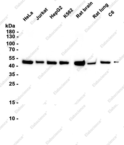 Recombinant beta II Tubulin Monoclonal Antibody - 1