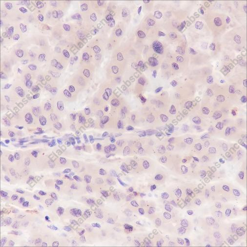 Recombinant Caspase-7 Monoclonal Antibody - 4