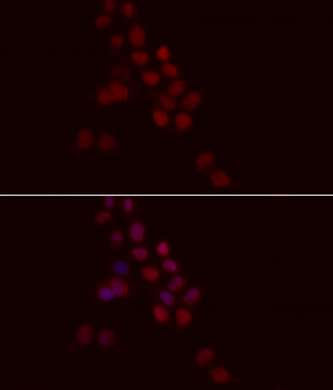 Immunofluorescence analysis of HeLa cells using Histone H1.0 Polyclonal Antibody at dilution of  1:100. Blue: DAPI for nuclear staining.