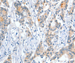 Placental Alkaline Phosphatase Polyclonal Antibody - 3