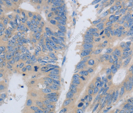 PAWR Polyclonal Antibody - 2
