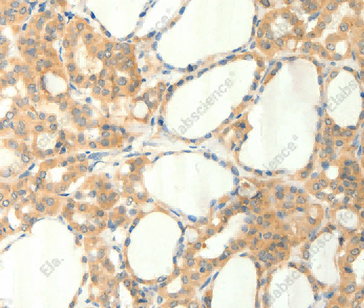 TRPM5 Polyclonal Antibody - 2