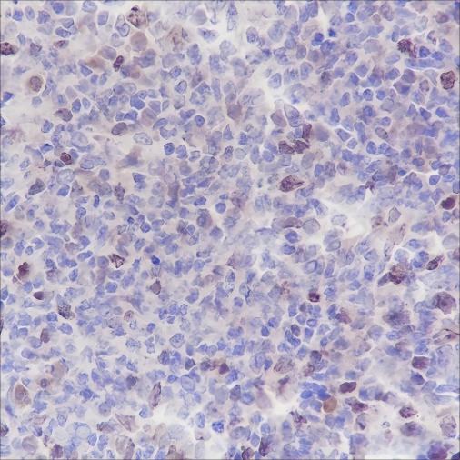 Recombinant Aurora B Monoclonal Antibody - 2