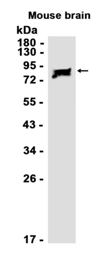 Recombinant beta-Catenin/CTNNB1 Monoclonal Antibody - 2