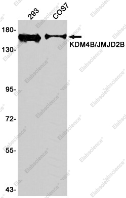 Recombinant KDM4B/JMJD2B Monoclonal Antibody - 1