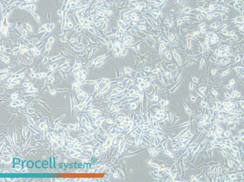 OMM-1 Cell Complete Medium - 1