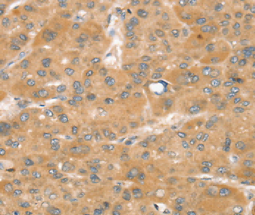 SNX2 Polyclonal Antibody - 2