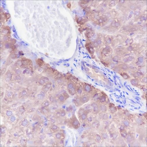 Recombinant CTEN Monoclonal Antibody - small - 2