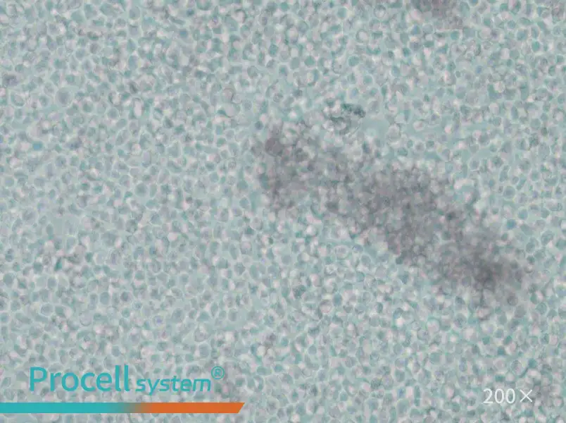 IM-9 Cell Complete Medium - small - 4