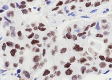 Recombinant MCM7 Monoclonal Antibody-searchlist-2
