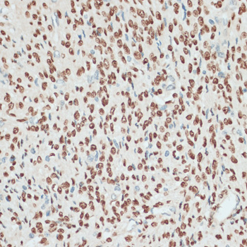 Immunohistochemistry of paraffin-embedded Human uterus using PGR Polyclonal Antibody at dilution of  1:100 (40x lens).