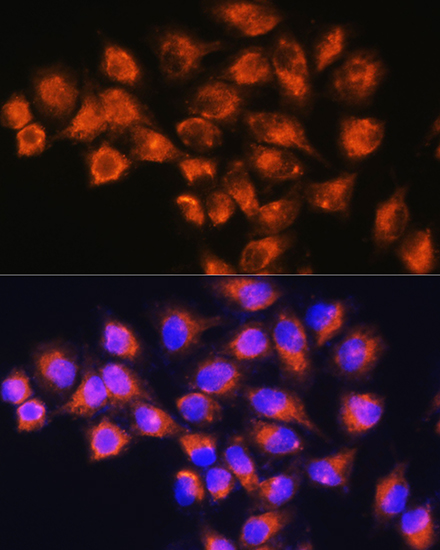 Immunofluorescence analysis of HeLa cells using NPB Polyclonal Antibody at dilution of 1:100. Blue: DAPI for nuclear staining.