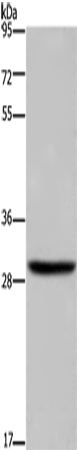 Western Blot analysis of A375 cell using DHRS3 Polyclonal Antibody at dilution of 1:600