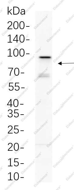 Recombinant EZH2 Monoclonal Antibody - 1