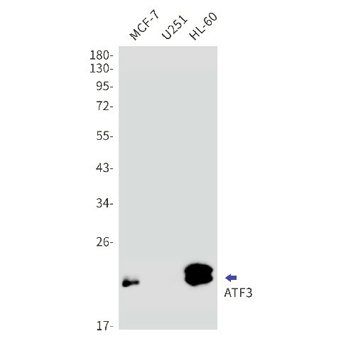 Western blot detection of ATF3 in MCF-7,U251,HL-60 cell lysates using ATF3 Rabbit mAb(1:1000 diluted).Predicted band size:21kDa.Observed band size:21kDa.