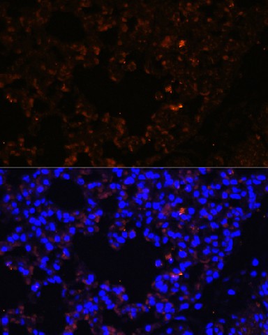 Immunofluorescence analysis of Mouse lung using TLR2 Polyclonal Antibody at dilution of 1:100. Blue: DAPI for nuclear staining.